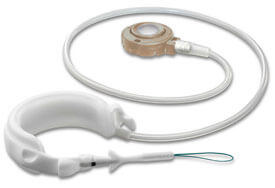 Gastric Banding Device Used In Laparoscopic Gastric Banding