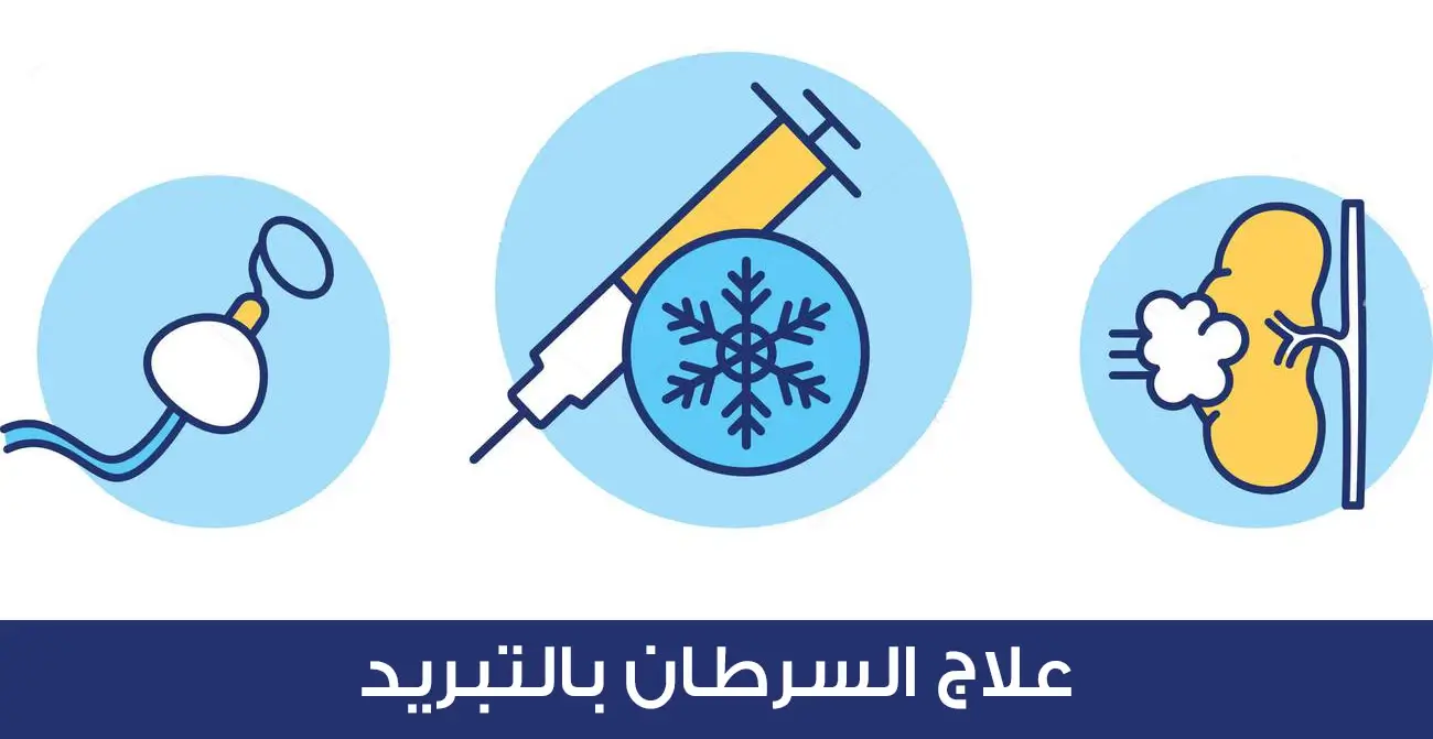  علاج السرطان بالتجميد في تركيا