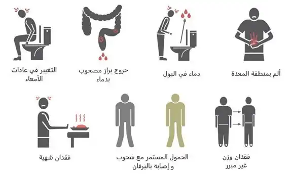 Common Signs Of Colorectal Cancer