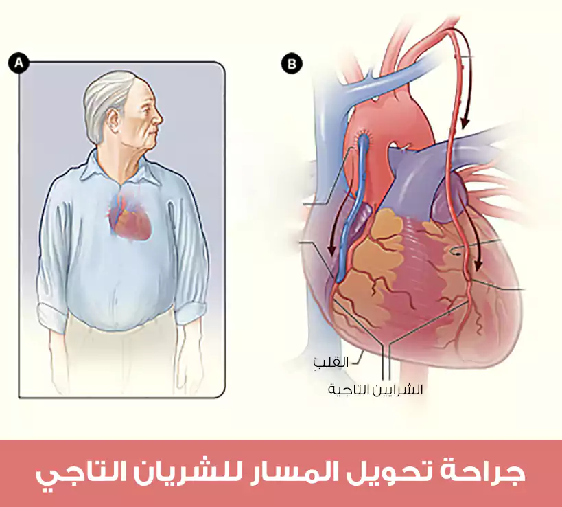 الموقع الطبيعي للقلب والشرايين التاجية