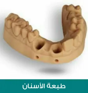 مثال عمل لطبعة الأسنان