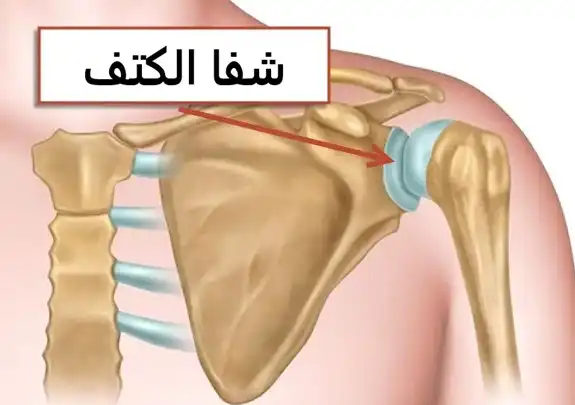 تمزق شفا الكتف 9 شفا الكتف هو القرص الغضروفي الذي يغطي الجوف الحقاني لعظم لوح الكتف