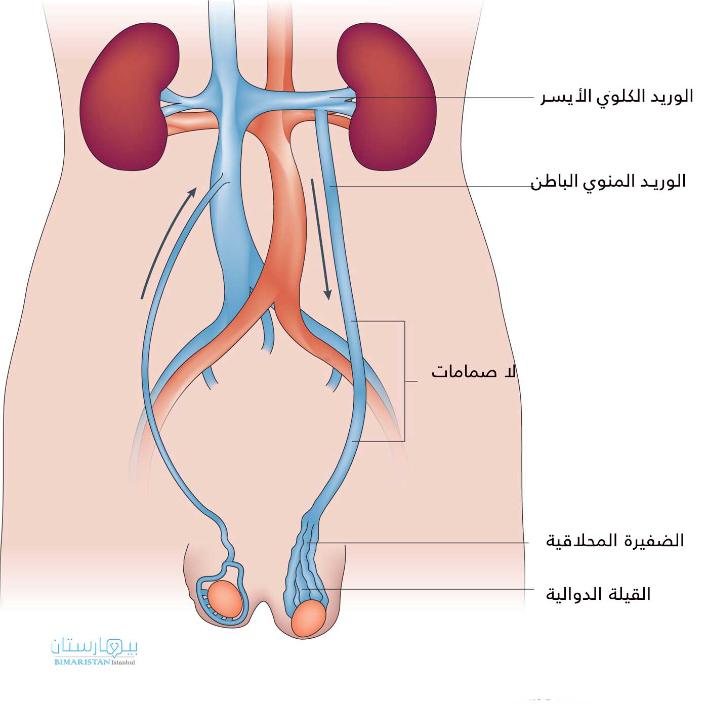 Valves In The Internal Spermatic Vein Malfunction And Blood Accumulates In The Tendinous Plexus, Which Expands