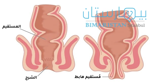 هبوط المستقيم بالصور