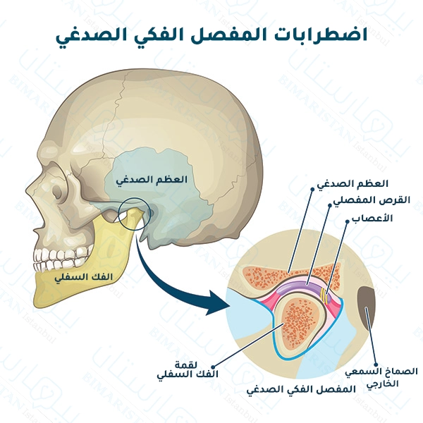 شكل-توضيحي-للمفصل-الفكي-الصدغي