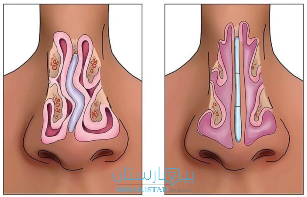 انحراف الوتيرة