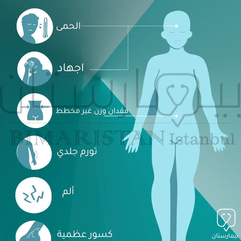 رسم يوضح أهم أعراض سرطان العظم