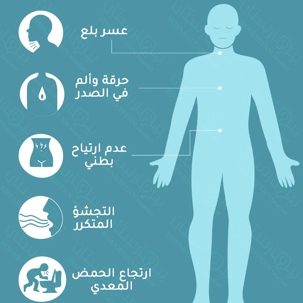 أعراض فتق الحجاب الحاجز والتي تشبه إلى حدٍ كبير اعراض الارتجاع المريئي