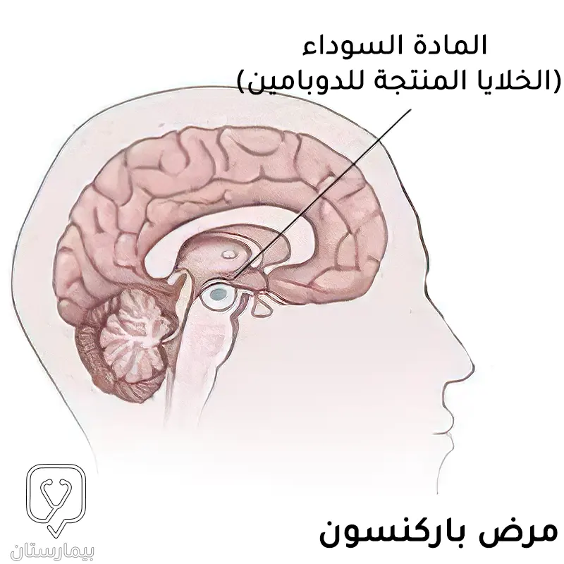 صورة تتحدث عن المادة السوداء في الدماغ (الخلايا المنتجة للدوبامين)