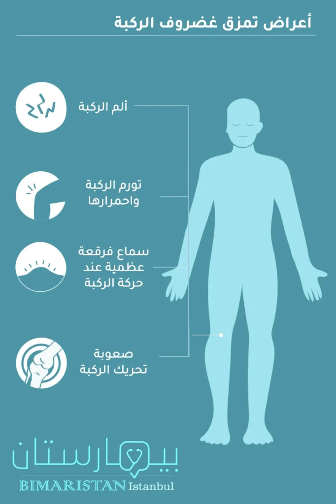 أعراض تمزق غضروف الركبة