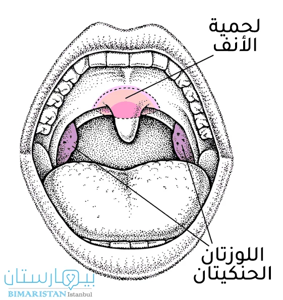 صورة توضح موقع لحمية الأنف المتضمة