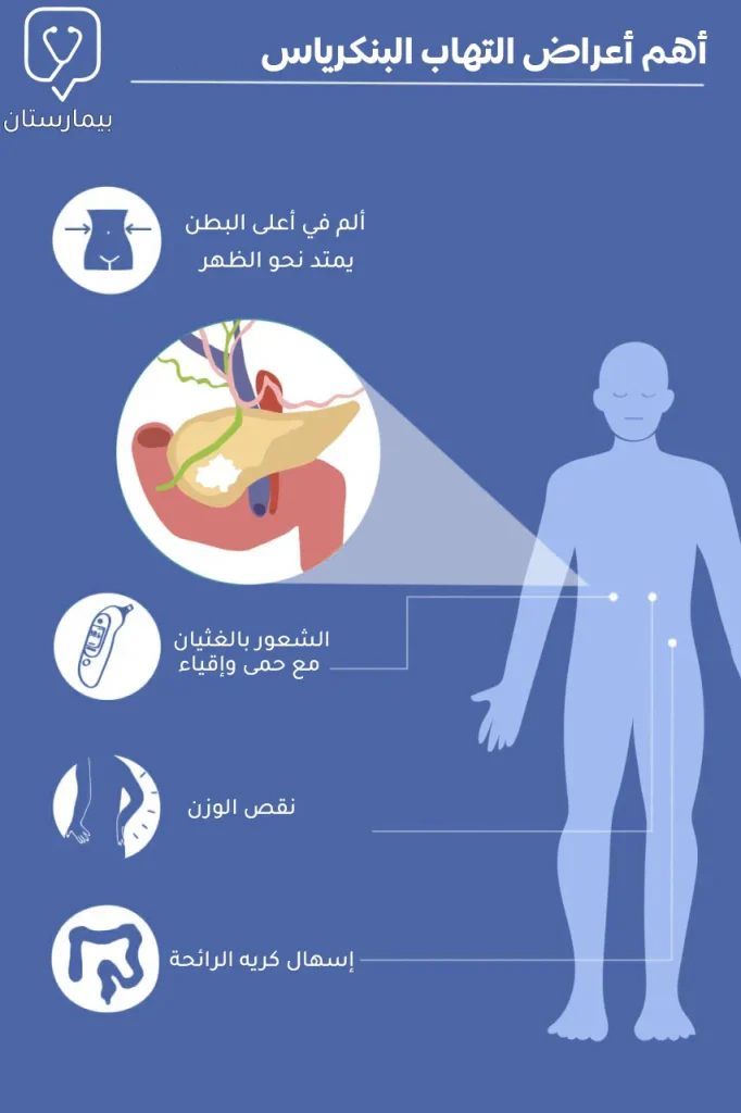 أعراض التهاب البنكرياس ومن أهمها ألم البطن العلوي المتجه نحو الظهر 