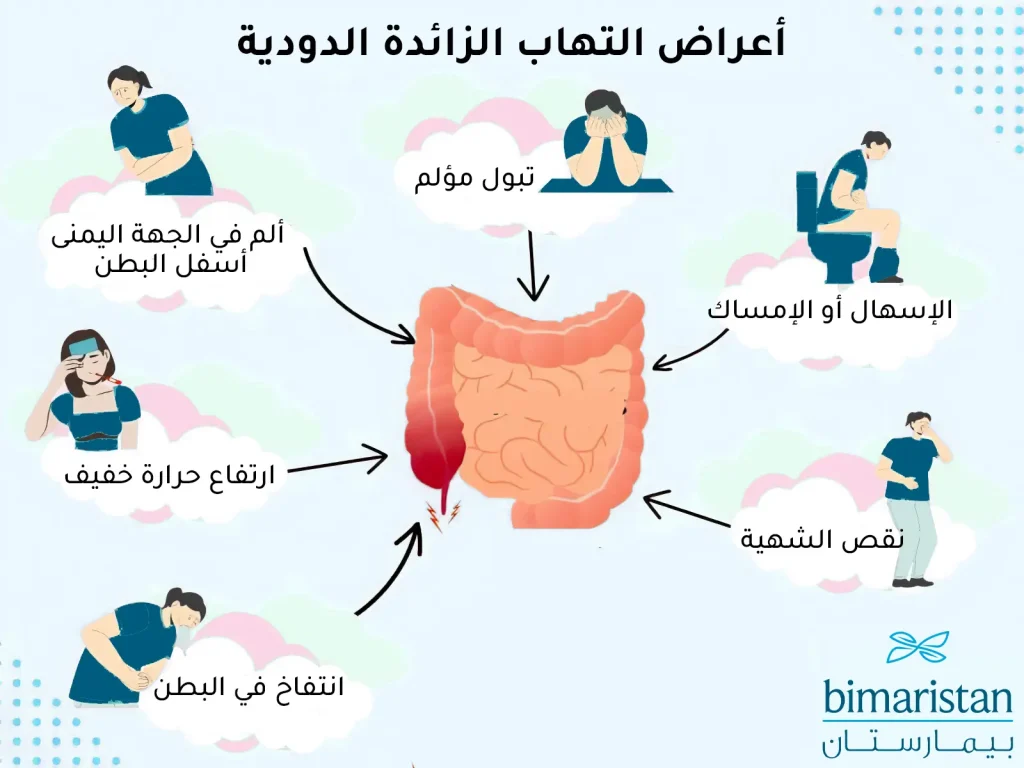 أهم أعراض التهاب الزائدة الدودية البسيط