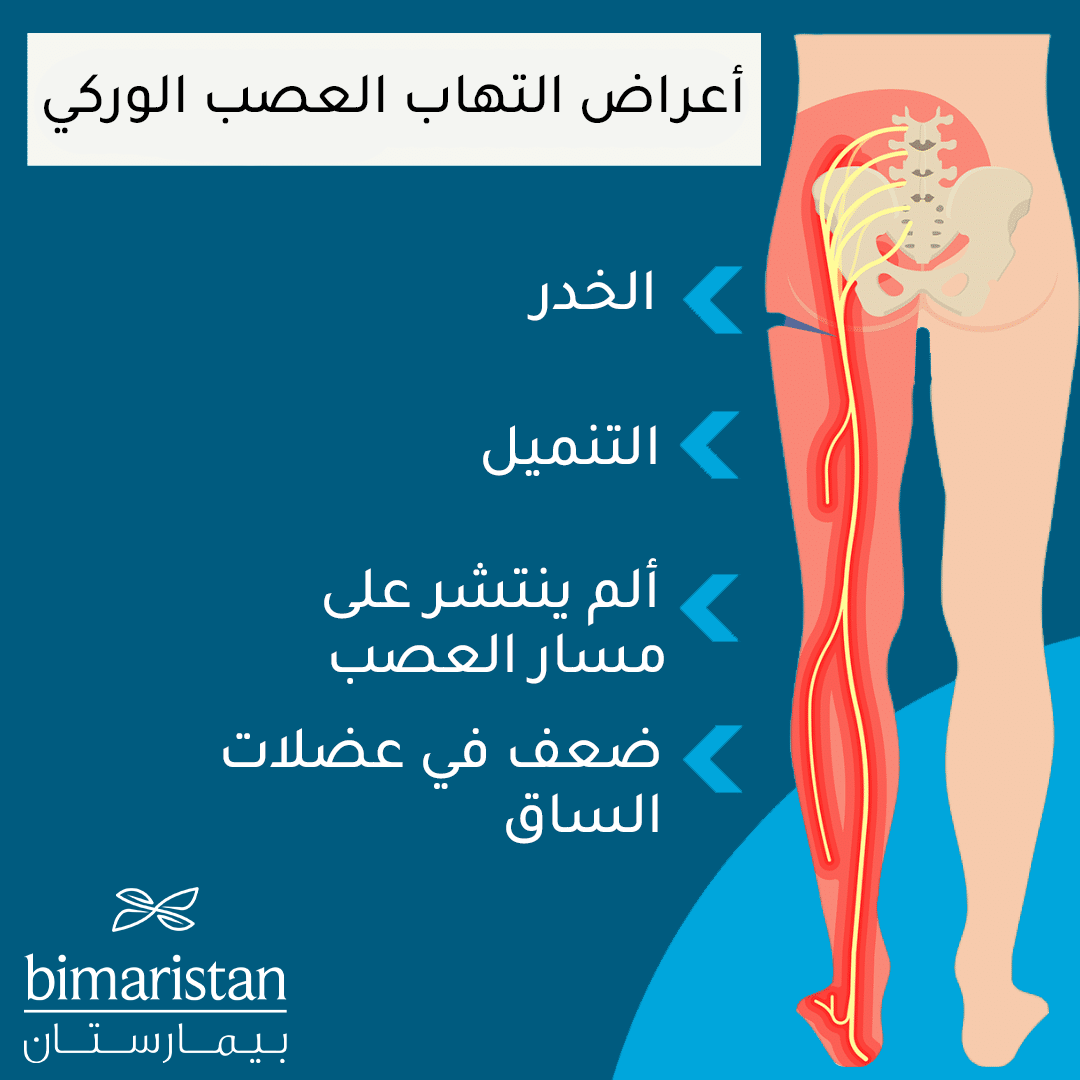 تشمل اعراض التهاب الصعب الوركي الخدر والتنميل والألم وضعف العضلات