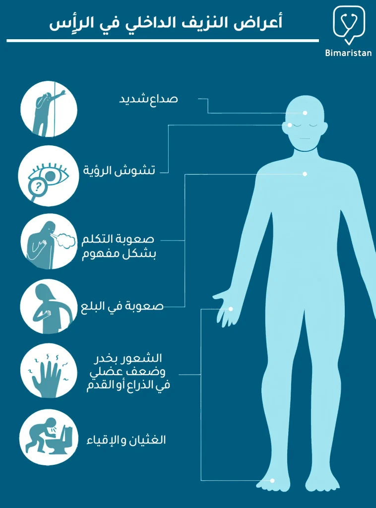 أشيع اعراض النزيف الداخلي في الرأس 