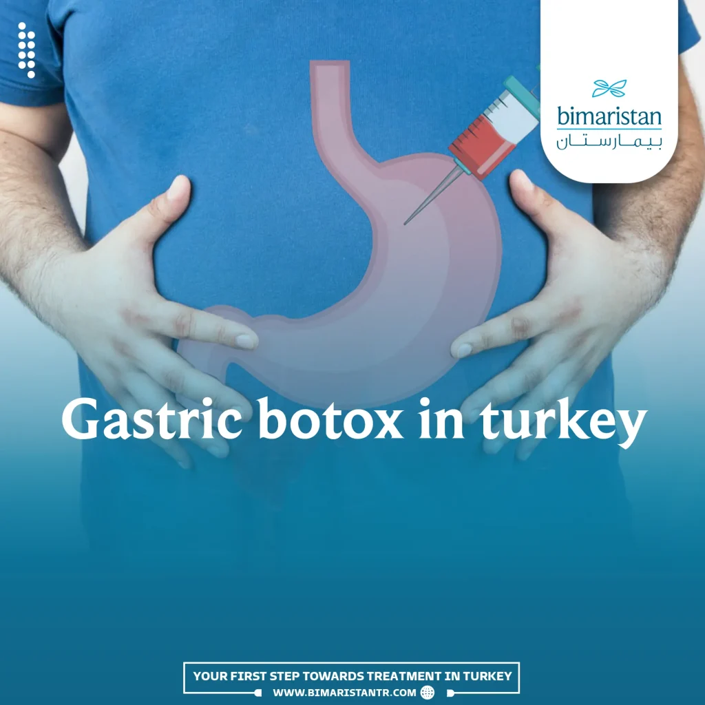 Gastric Botox In Turkey | Best Treatment For Obesity 2024