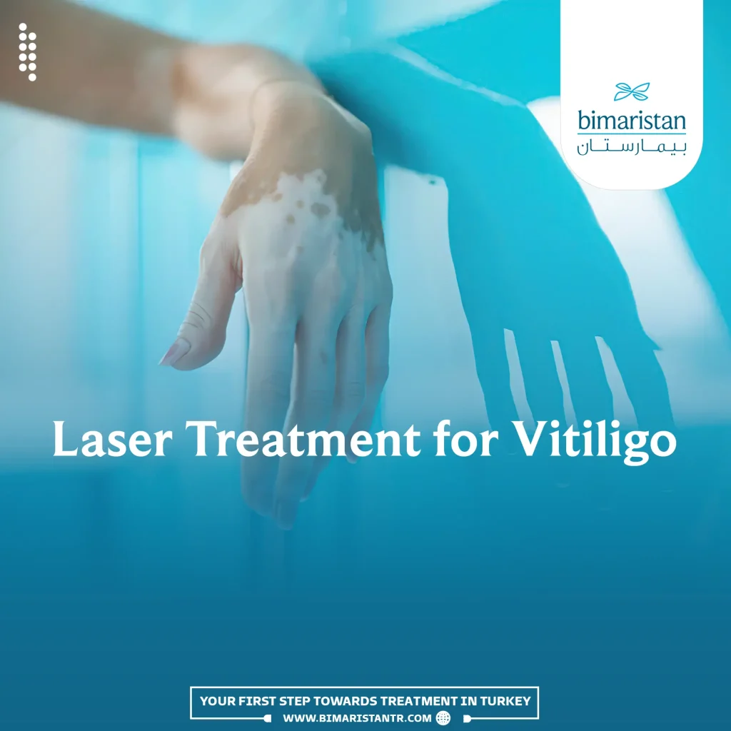 Laser Treatment For Vitiligo