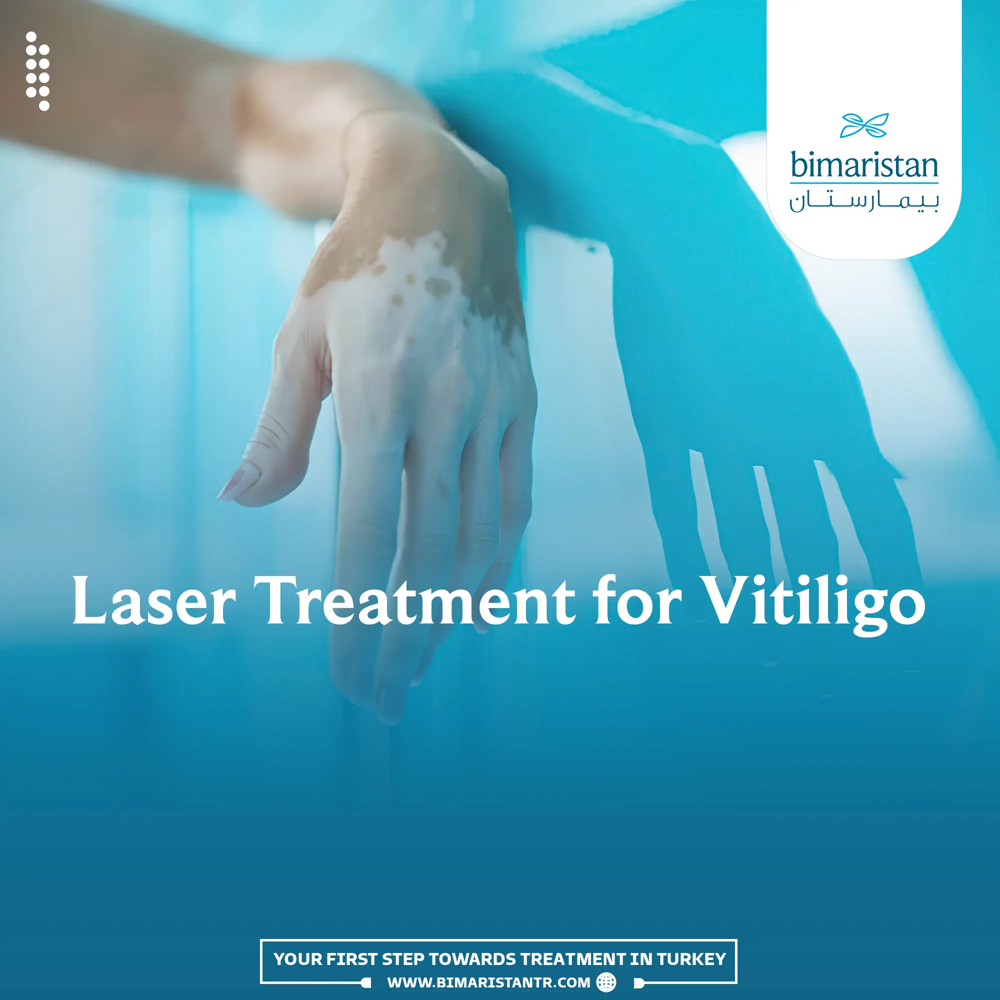 Laser Treatment For Vitiligo