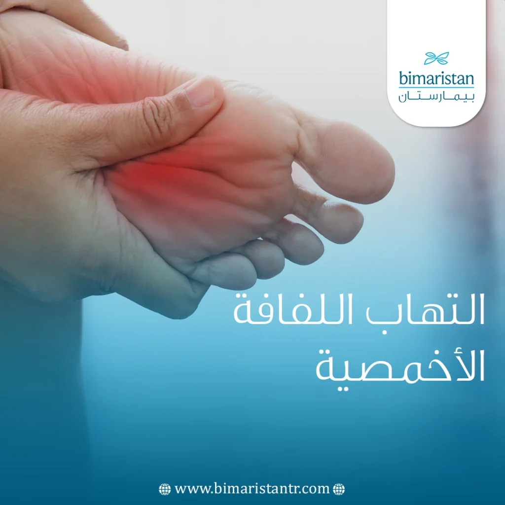 أحدث طرق علاج التهاب اللفافة الأخمصية في تركيا - بيمارستان