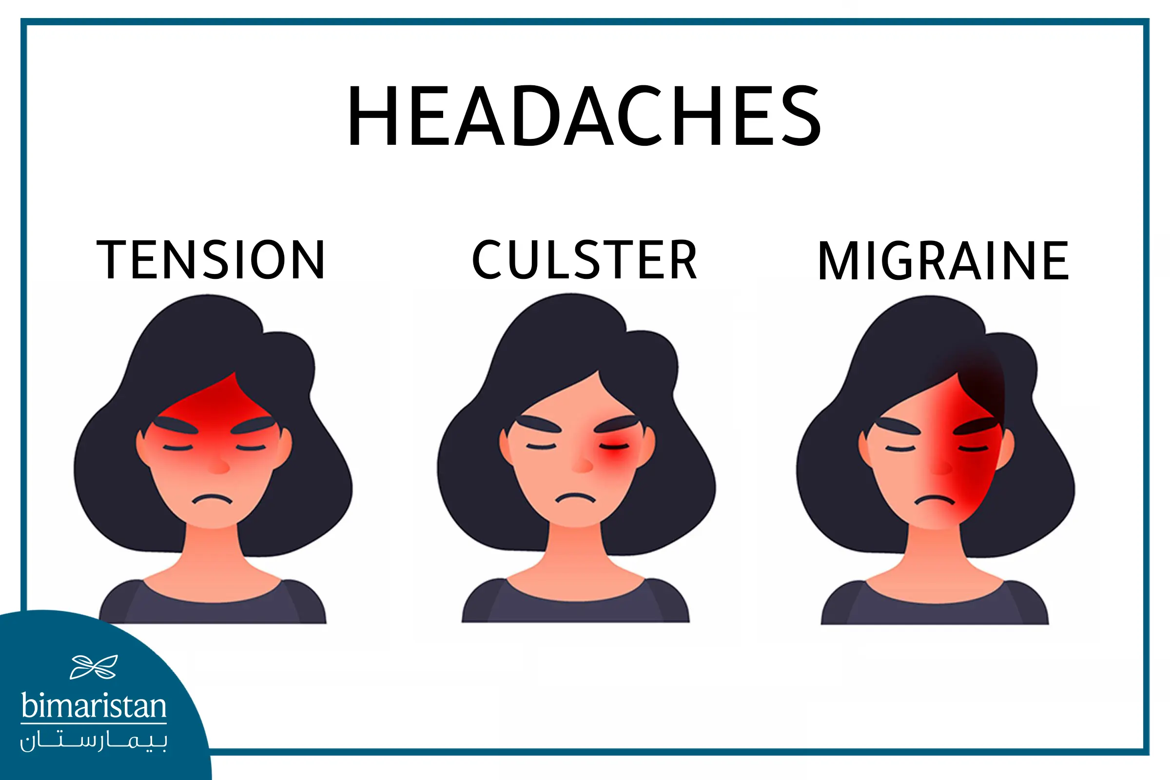 The Difference Between Migraine, Tension And Cluster Headache Location