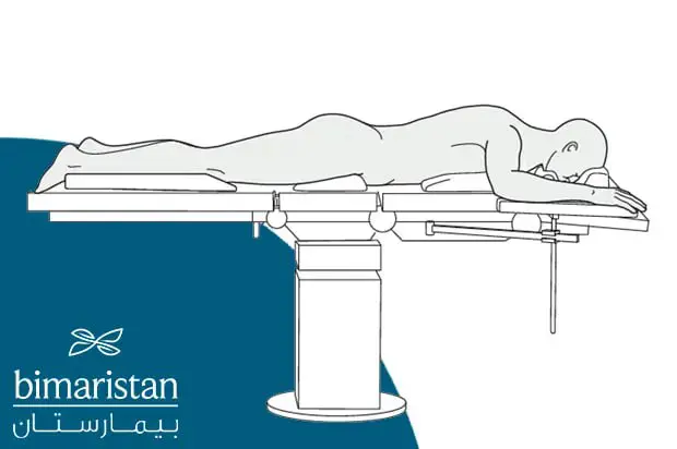 Patient Positioning During The Endoscopic Discectomy Procedure.