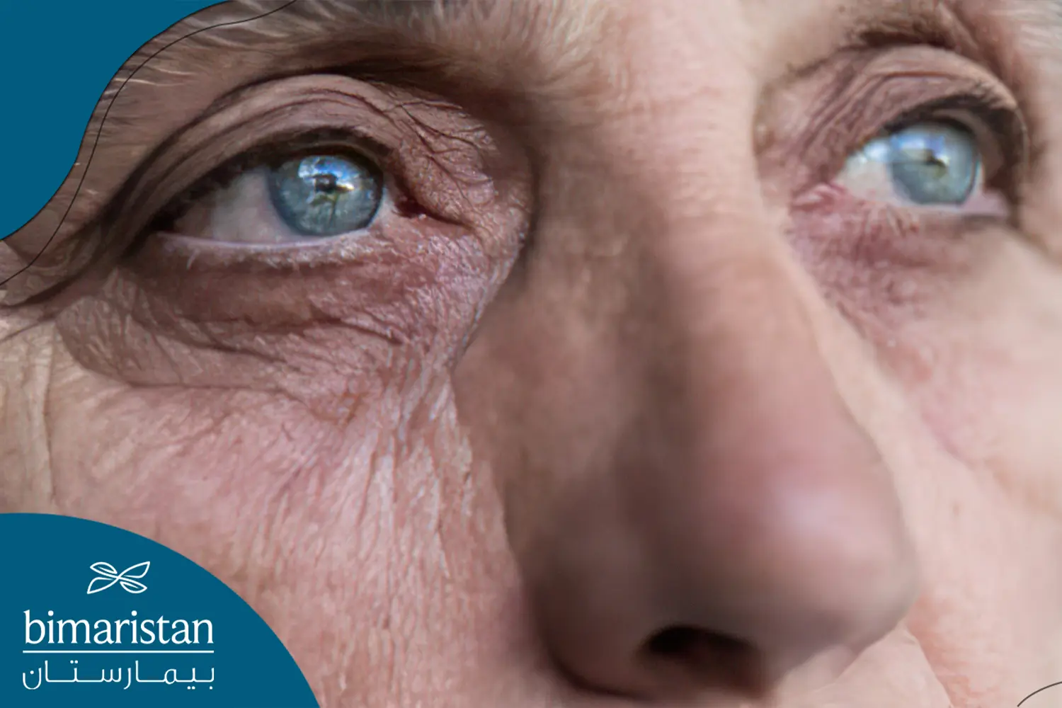 Teardrop Test That May Aid Parkinson’S Diagnosis