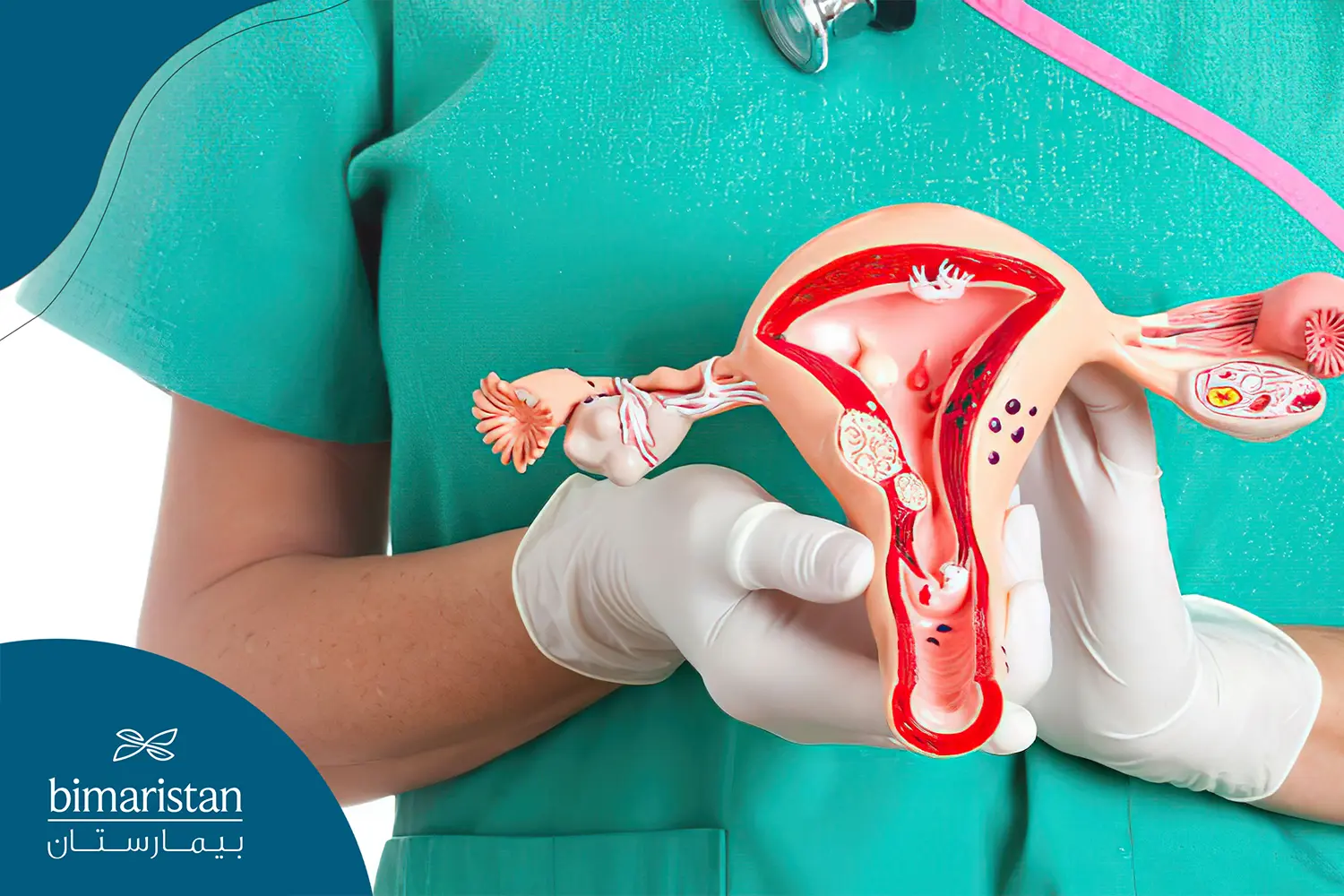 Blood Test Could Aid Ovarian Cancer Diagnosis 1 Blood Test Could Aid Ovarian Cancer Diagnosis