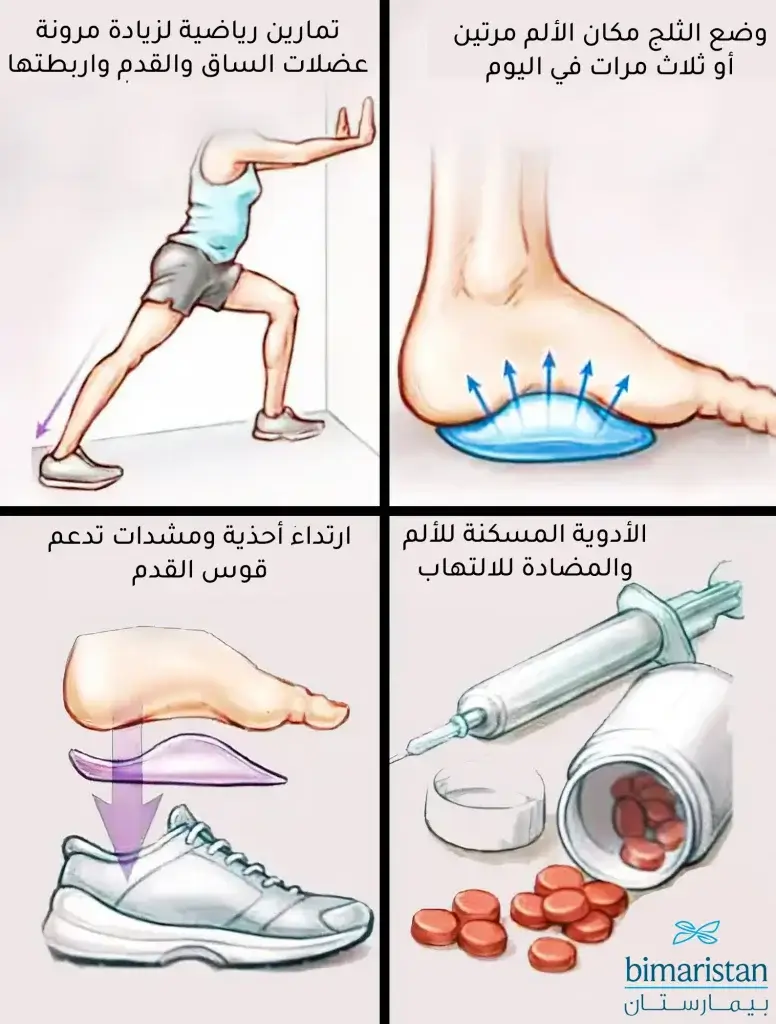 صورة توضح طريقة علاج التهاب اللفافة الأخمصية بشكل محافظ