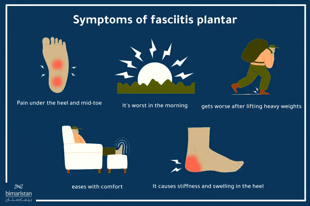 Plantar Fasciitis Symptoms