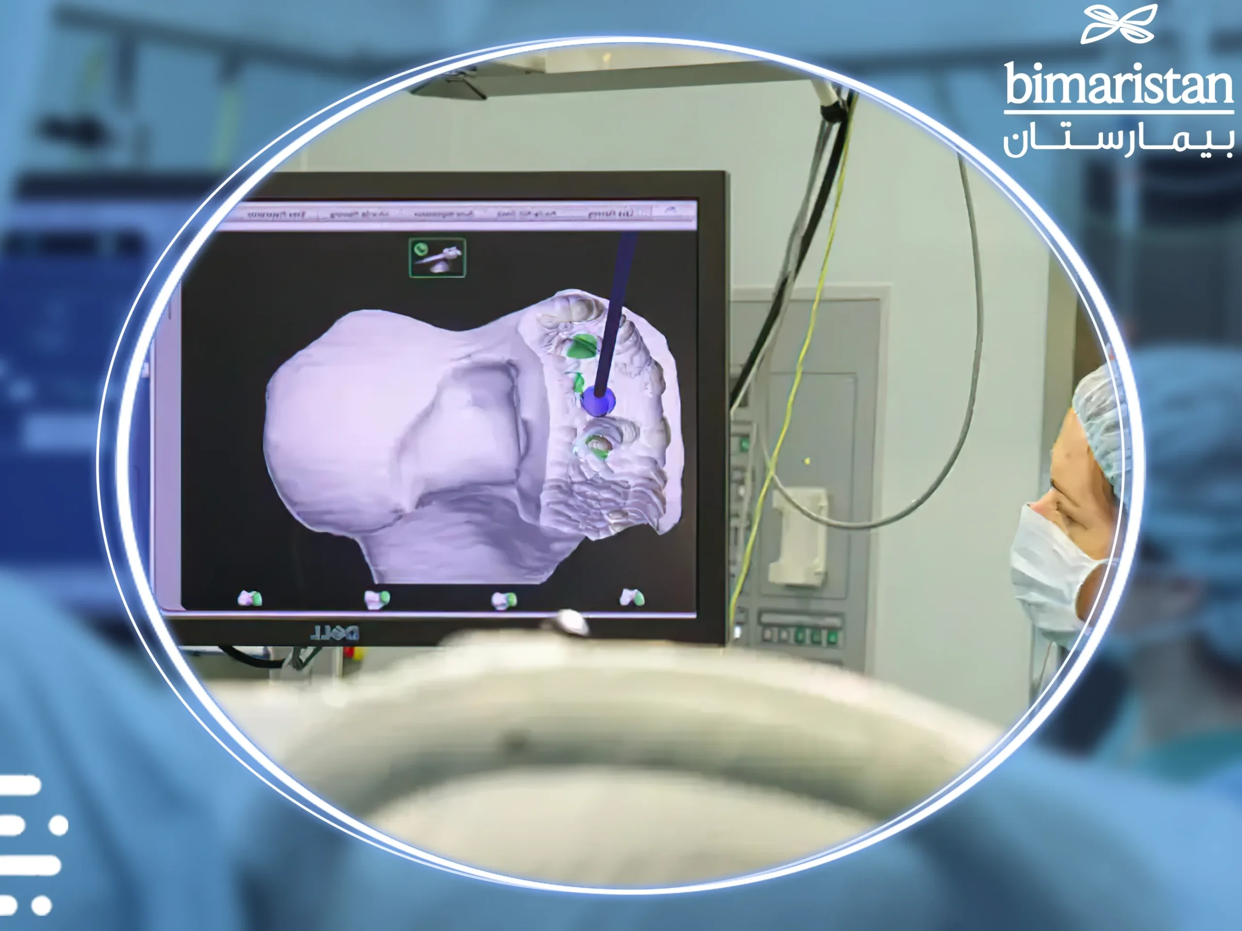 A picture illustrating the complete planning and analysis of the knee joint before and during its replacement with the robot