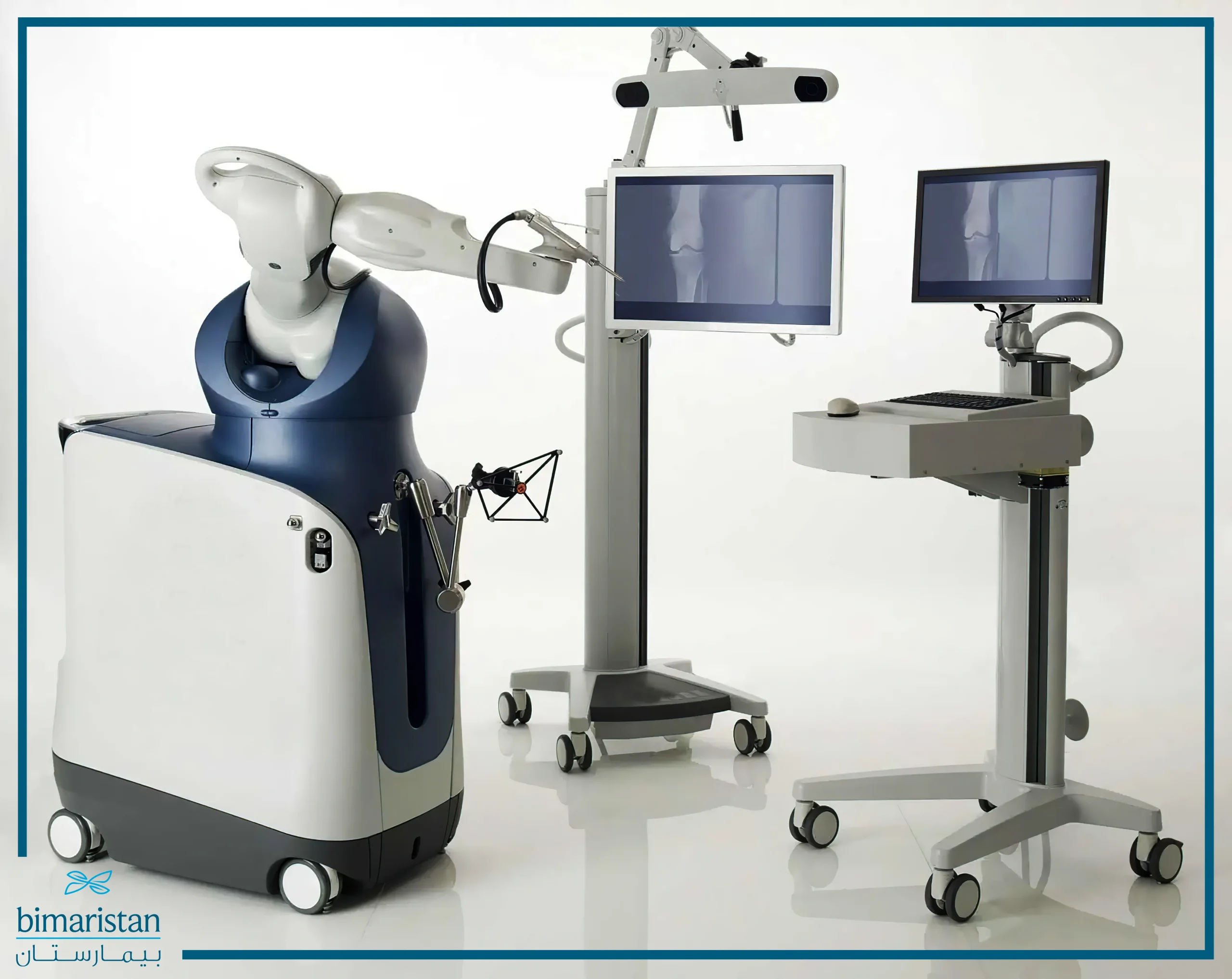 A picture showing the robot used for knee replacement surgery robotically in Turkey
