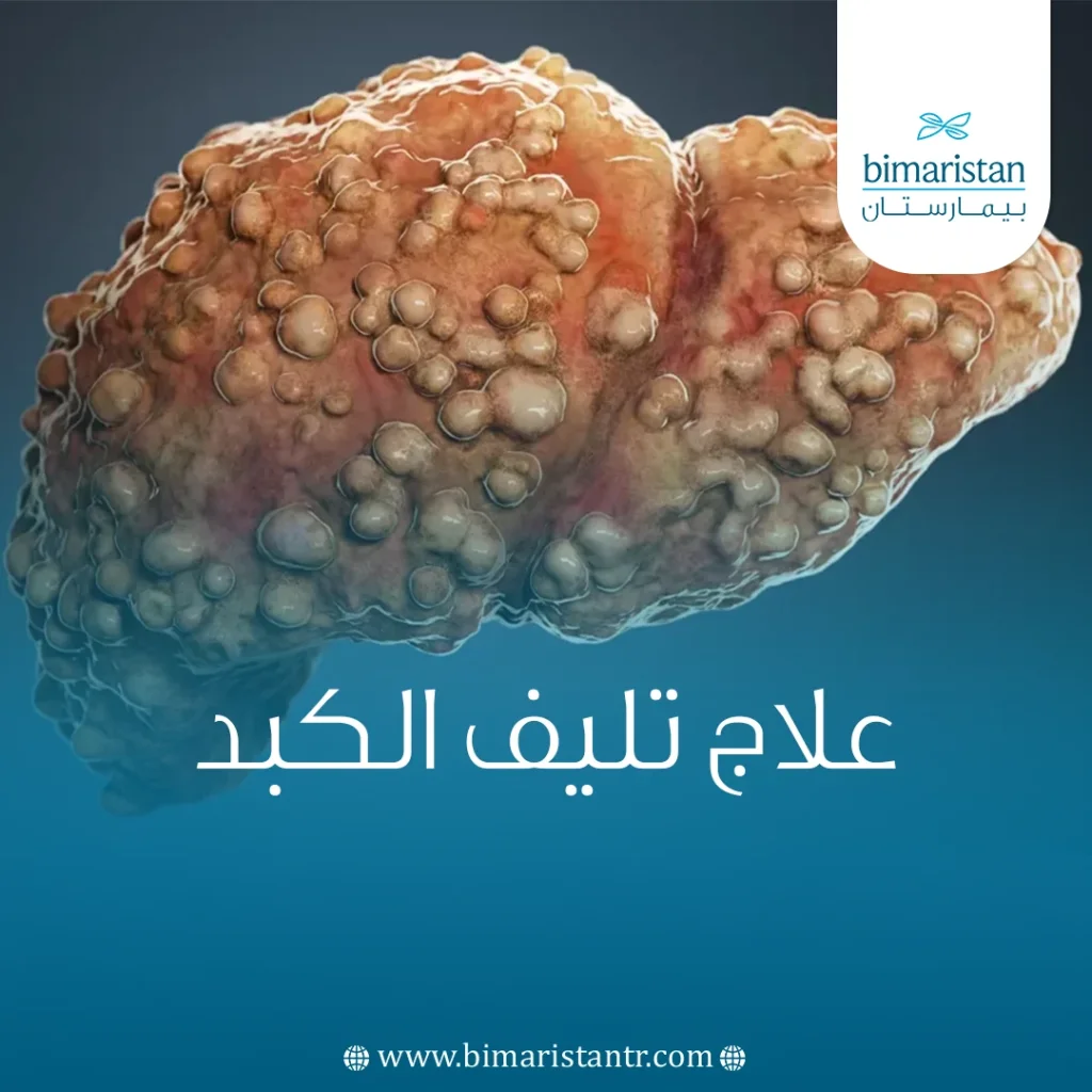 صورة غلاف تتحدث عن علاج تليف الكبد