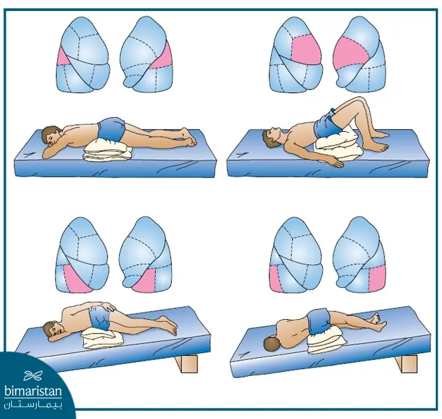 Lung Abscess Treatment: Removal &Amp; Prevention Guide 5 Lung Abscess Treatment With Respiratory Physiotherapy