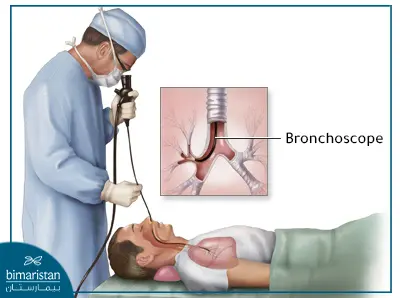 Lung Abscess Treatment: Removal &Amp; Prevention Guide 6 Lung Abscess Treatment Via Bronchoscopy In Turkey