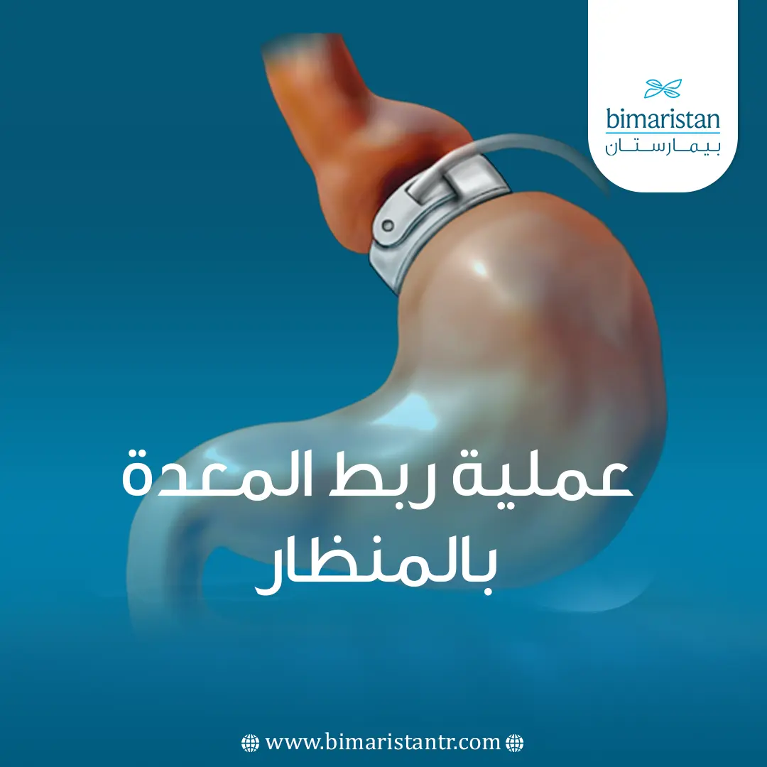 عملية ربط المعدة بالمنظار في تركيا