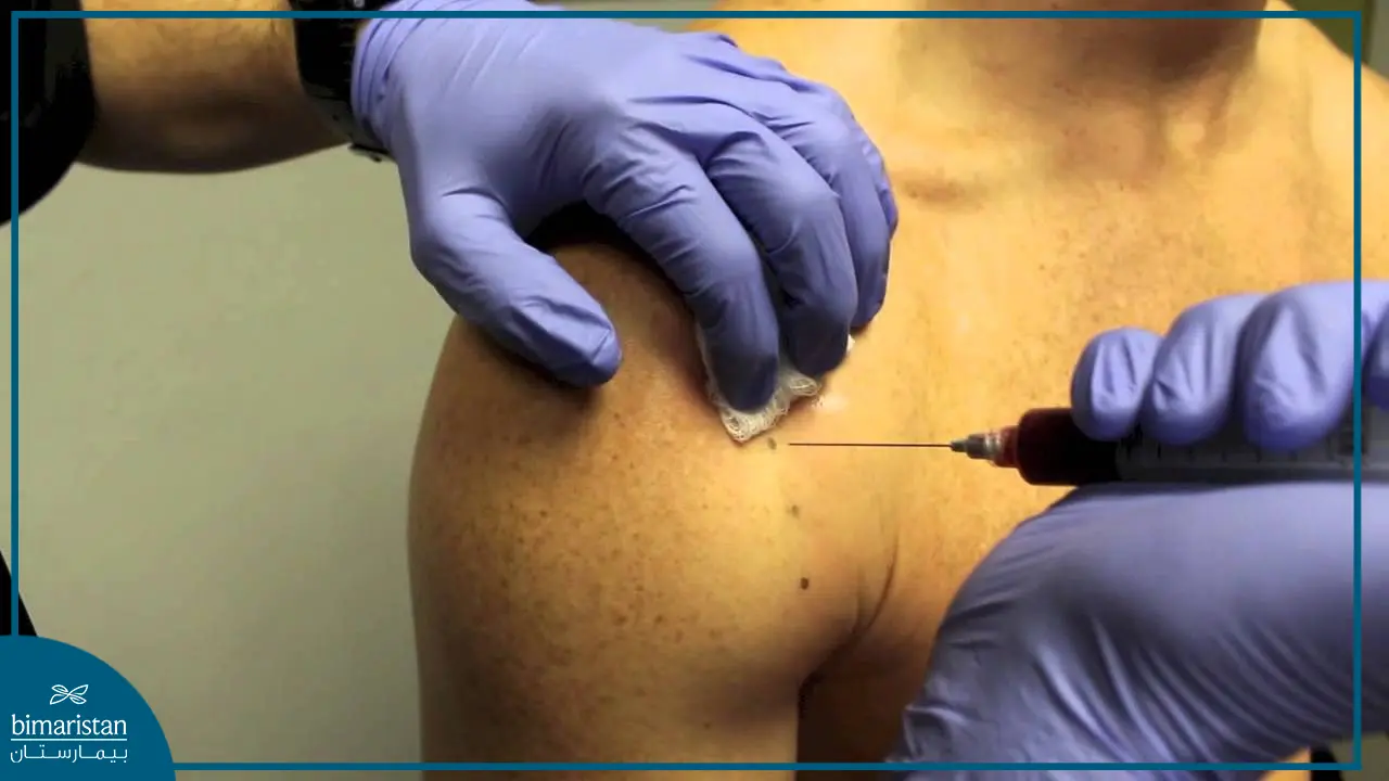 A Picture Of Plasma Injection Procedure In The Shoulder In Turkey
