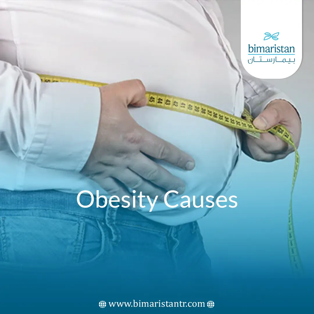 Causes Of Excessive Obesity