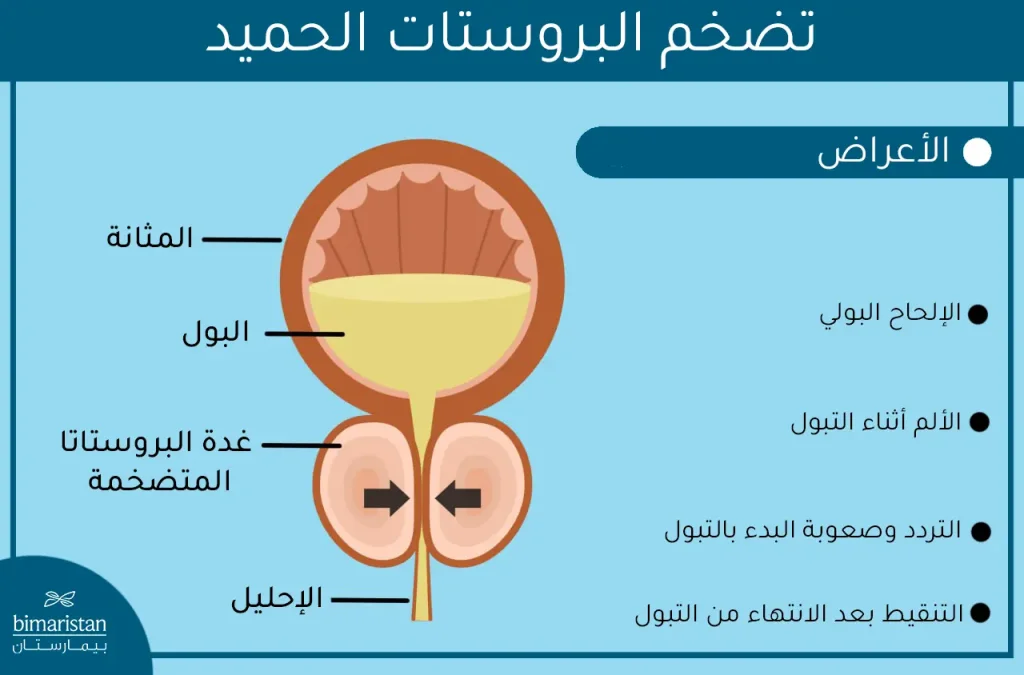 أعراض تضخم البروستات عند الرجال