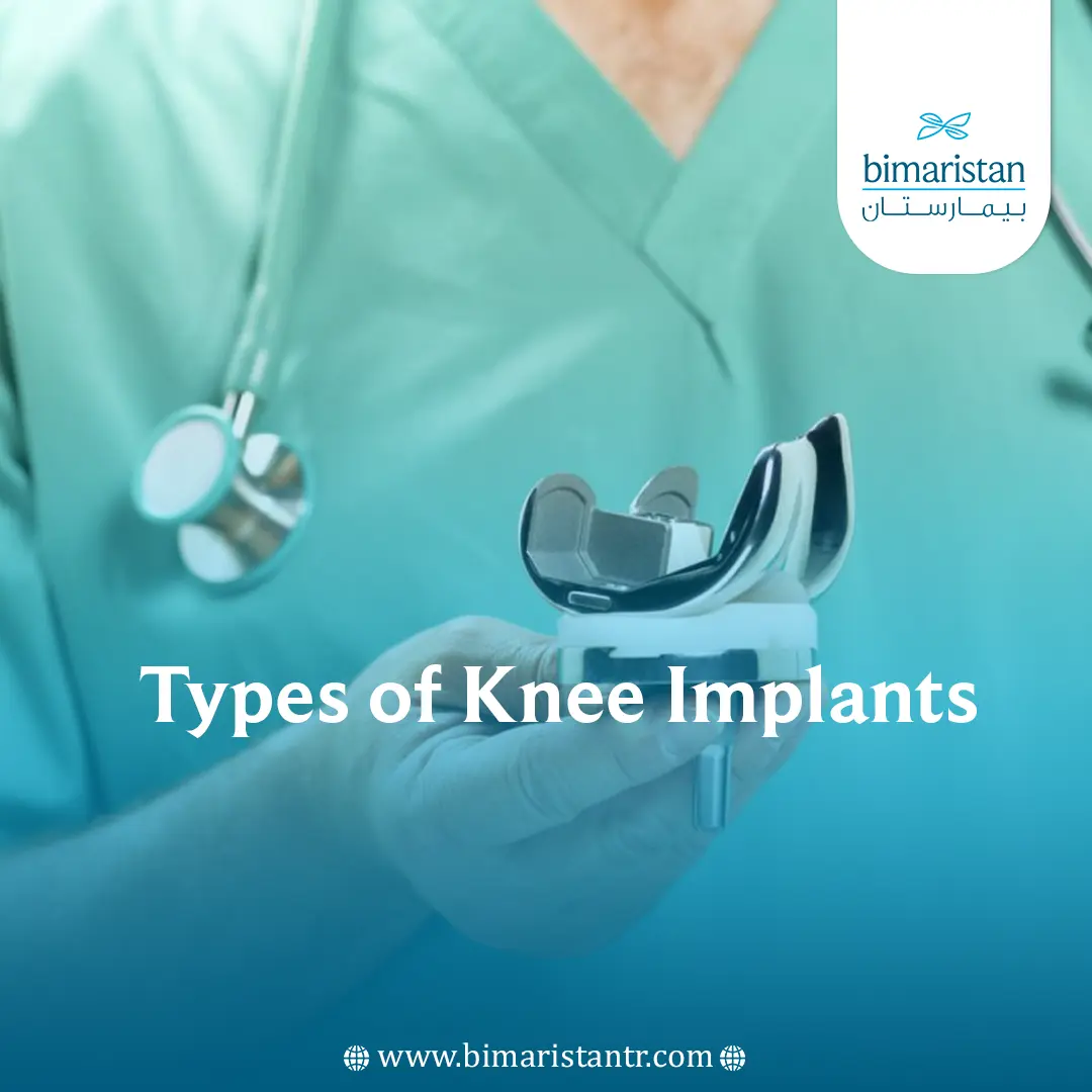 Best Types of knee implants in turkey - بيمارستان