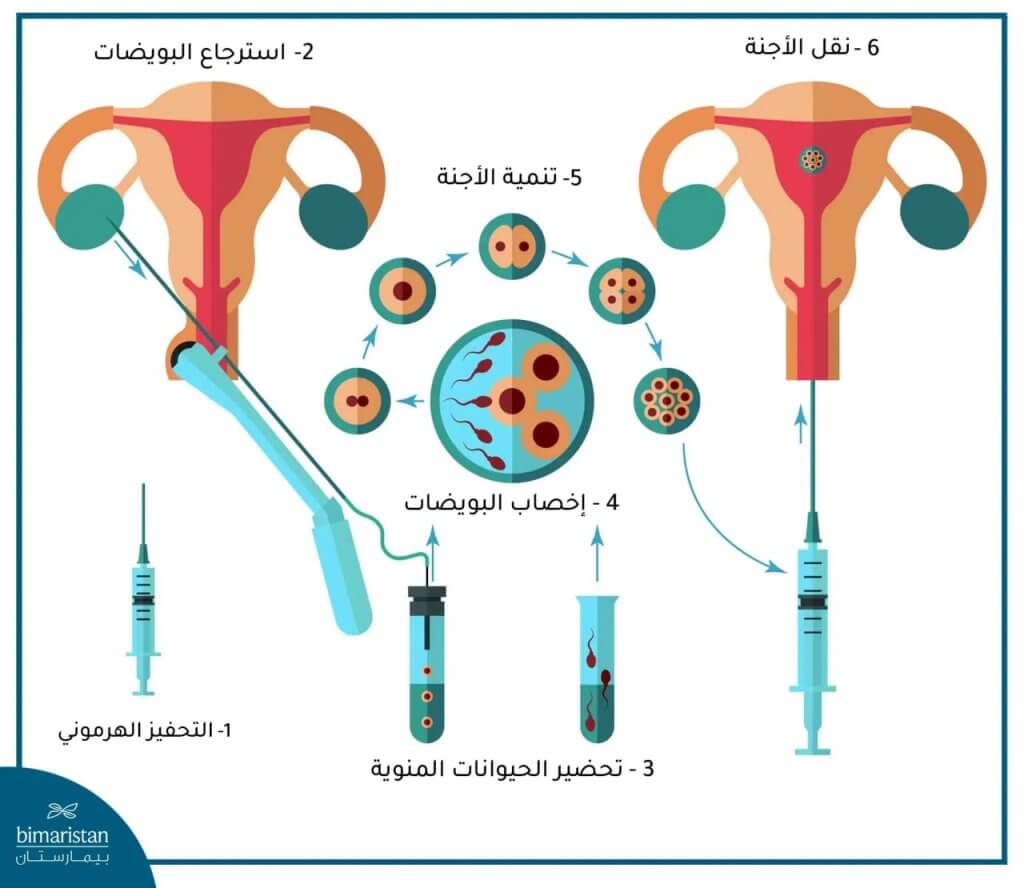 خطوات التلقيح الصناعي بالصور