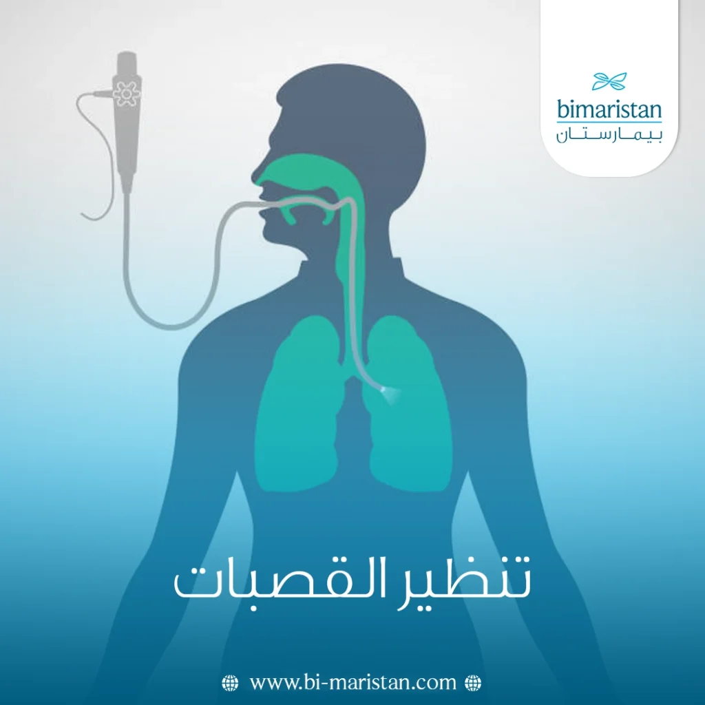 تنظير القصبات