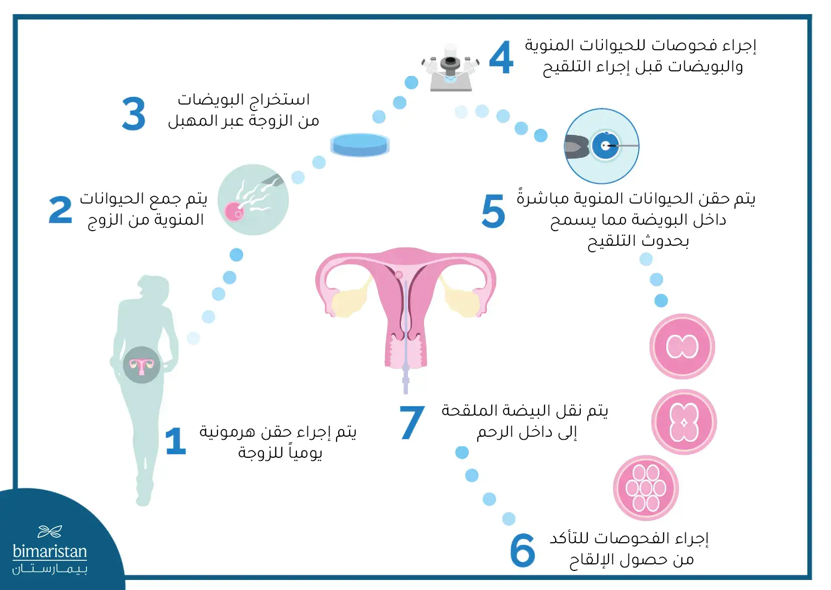 مراحل عملية الحقن المجهري