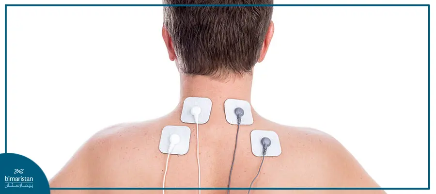 Treatment Of Cervical Bone Spurs Via Transcutaneous Electrical Nerve Stimulation (Tens)