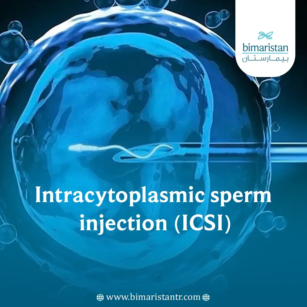 Intracytoplasmic Sperm Injection (Icsi)