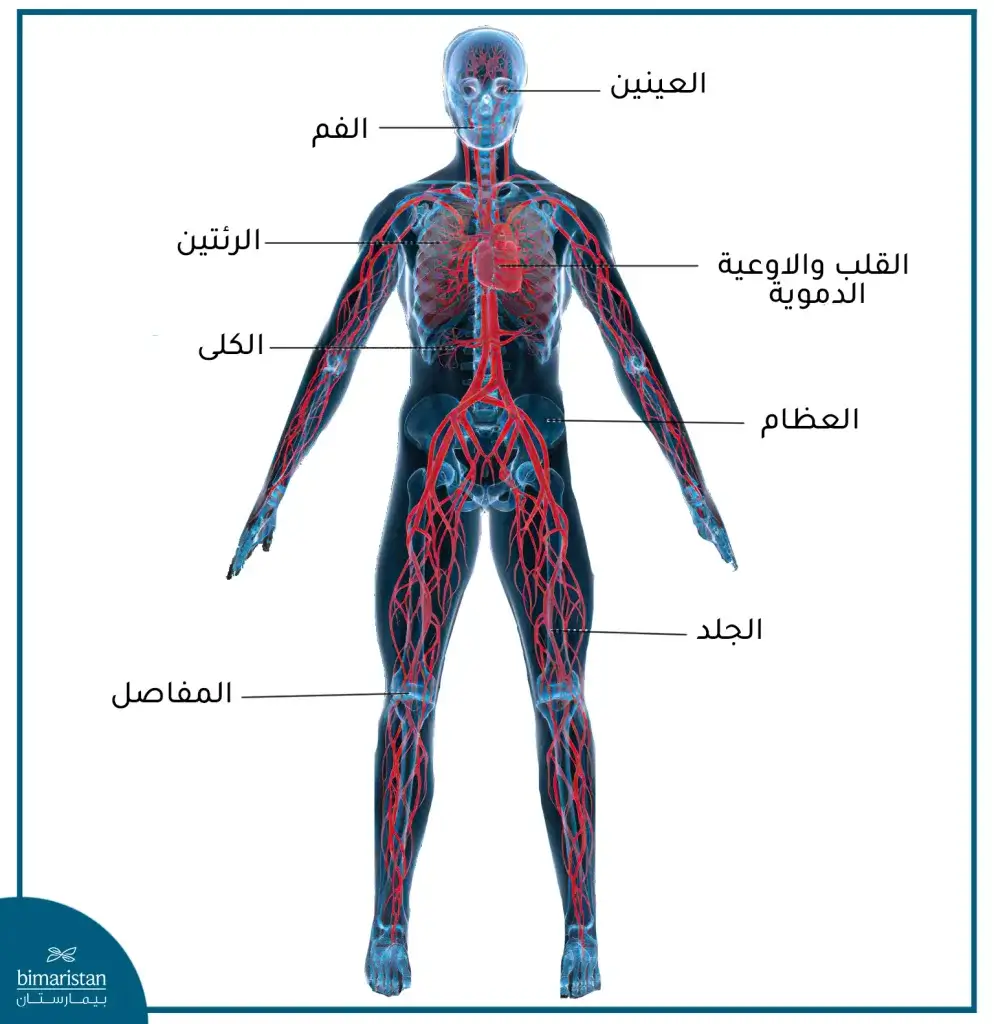 الأنسجة والأعضاء الي قد يؤثر عليها التهاب المفاصل الروماتيدي