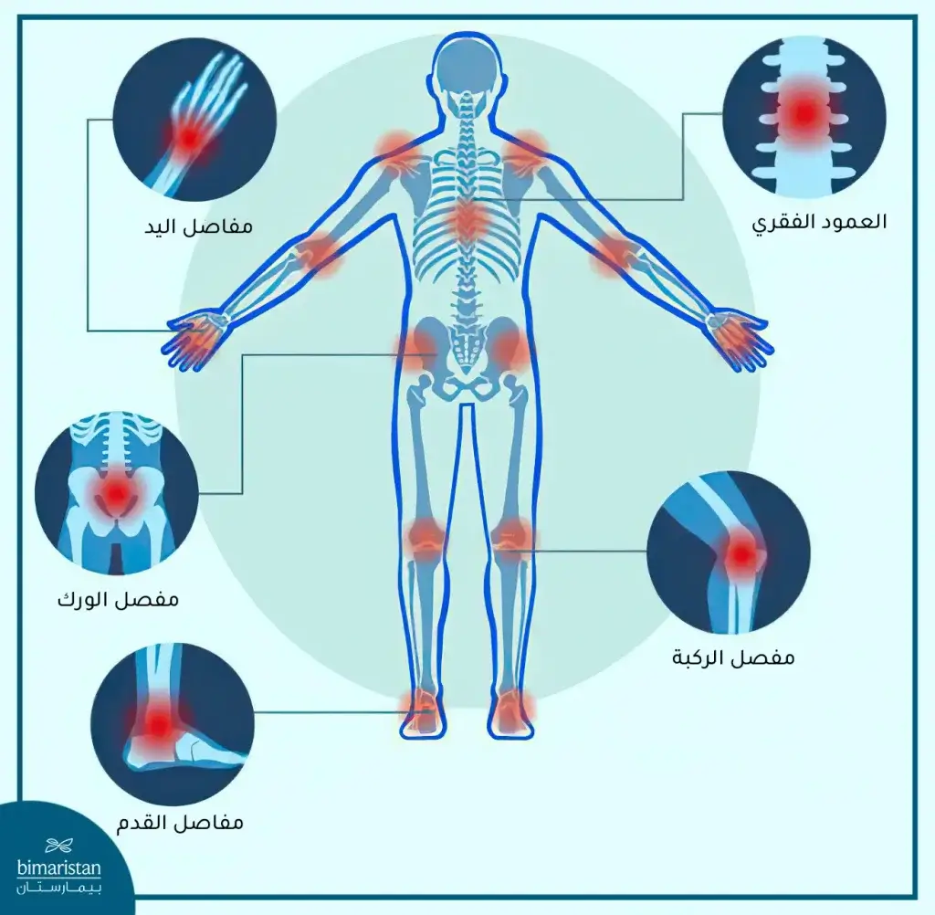 المفاصل الأكثر عرضة للإصابة بأعراض الروماتيزم