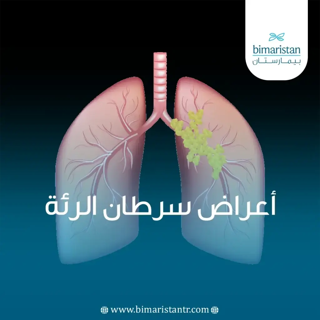 صورة غلاف لمقالة أعراض سرطان الرئة