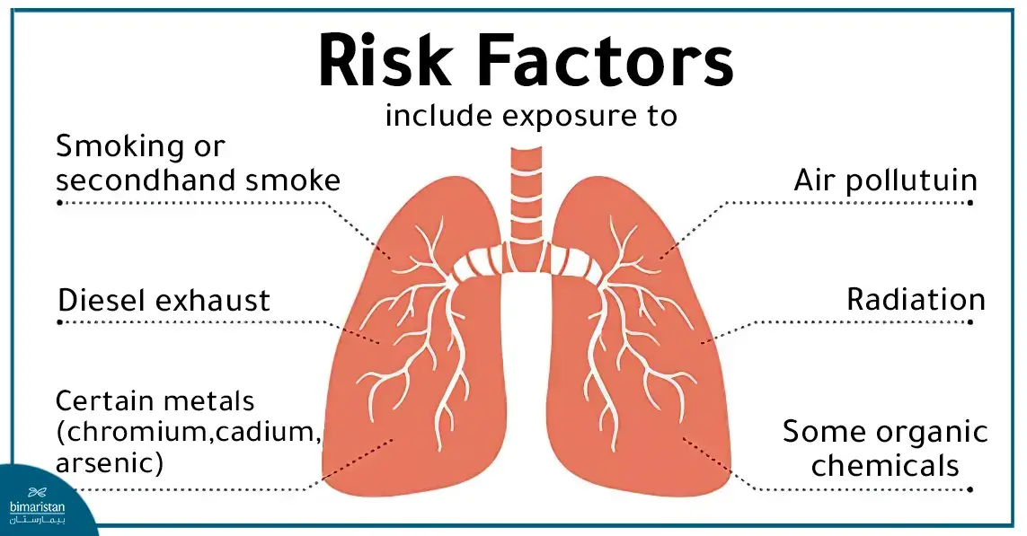 Lung Cancer Causes And Risk Factors