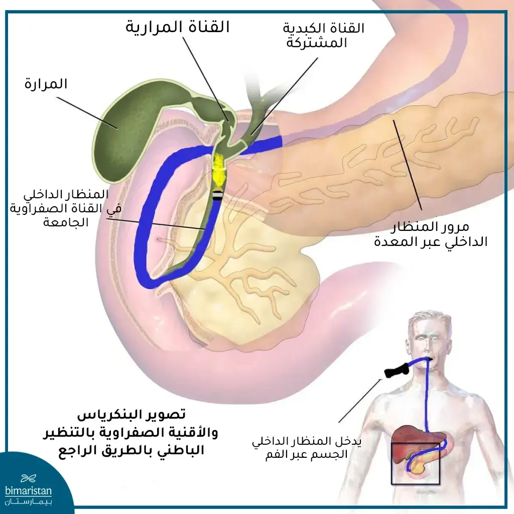 جراحة الكبد والبنكرياس والقنوات الصفراوية