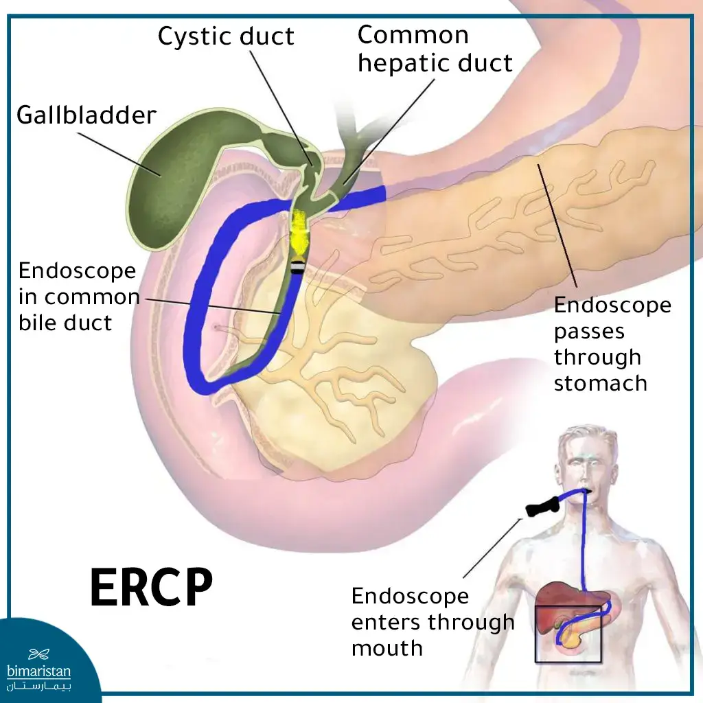 Hepato-Pancreato-Biliary (Hpb) Surgery